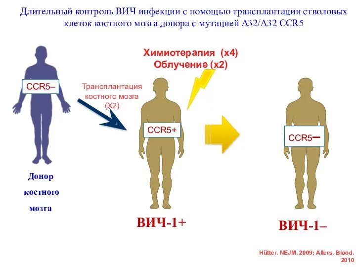 Длительный контроль ВИЧ инфекции с помощью трансплантации стволовых клеток костного мозга донора с мутацией Δ32/Δ32 CCR5