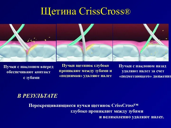 Щетина CrissCross®