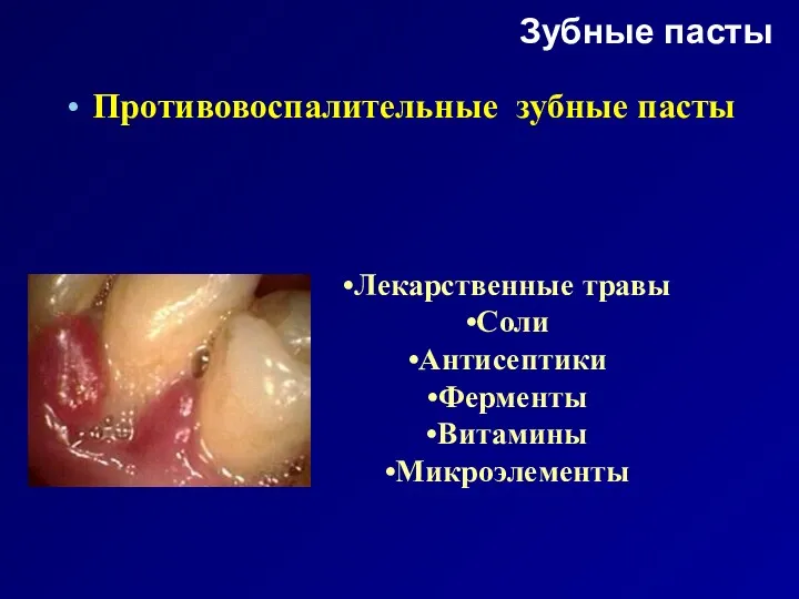 Зубные пасты Противовоспалительные зубные пасты Лекарственные травы Соли Антисептики Ферменты Витамины Микроэлементы