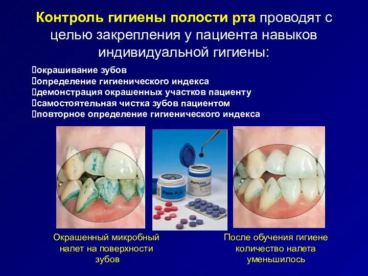 Контроль гигиены полости рта проводят с целью закрепления у пациента
