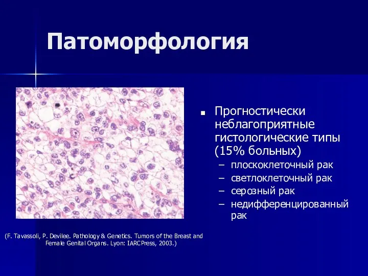 Патоморфология Прогностически неблагоприятные гистологические типы (15% больных) плоскоклеточный рак светлоклеточный