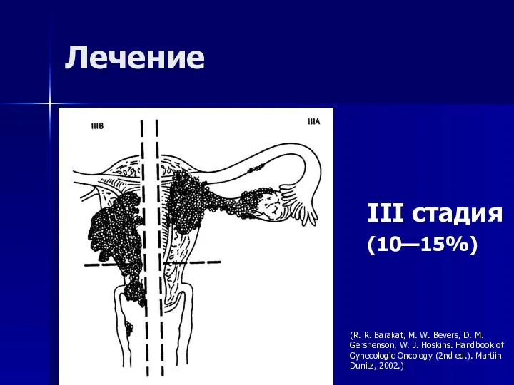 Лечение III стадия (10—15%) (R. R. Barakat, M. W. Bevers,