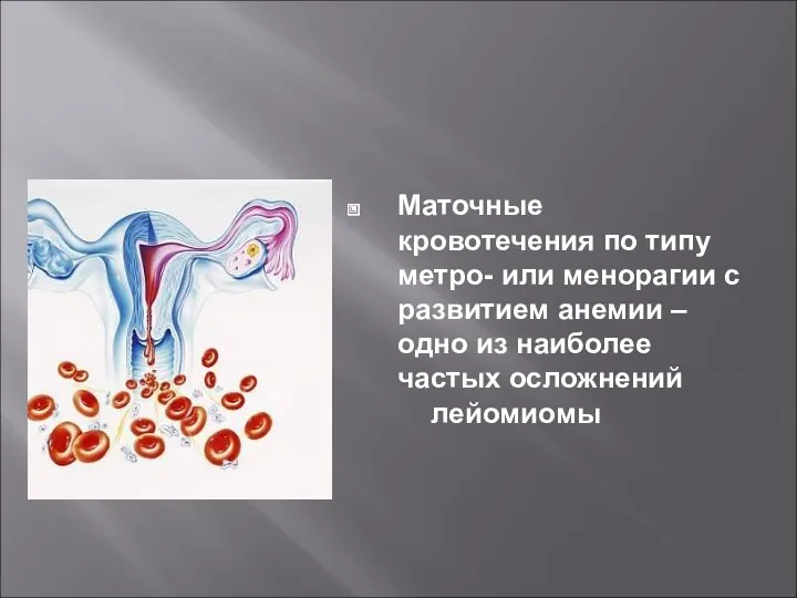 Маточные кровотечения по типу метро- или менорагии с развитием анемии