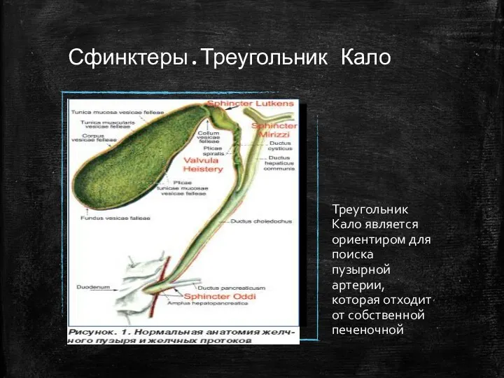 Сфинктеры.Треугольник Кало Треугольник Кало является ориентиром для поиска пузырной артерии, которая отходит от собственной печеночной