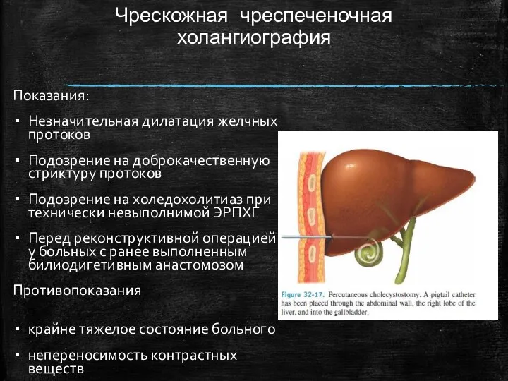 Чрескожная чреспеченочная холангиография Показания: Незначительная дилатация желчных протоков Подозрение на