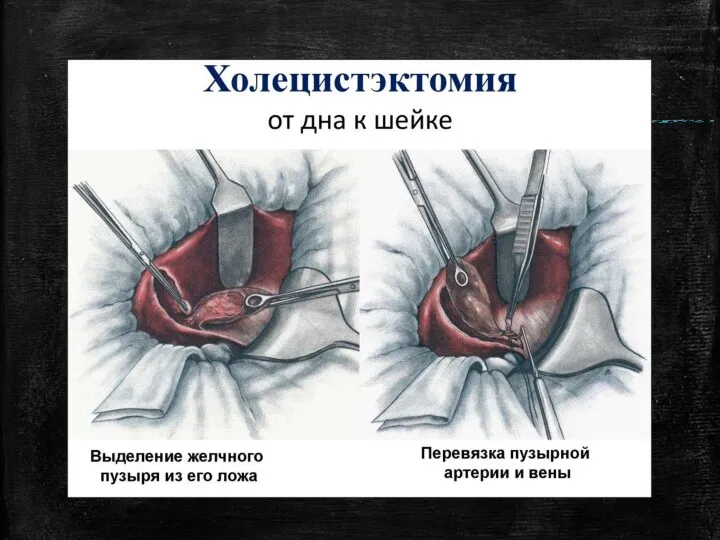 картинки