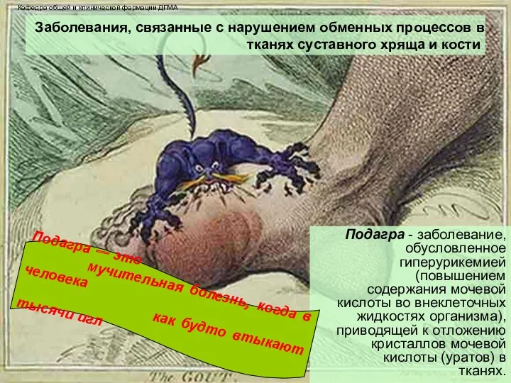 Заболевания, связанные с нарушением обменных процессов в тканях cycтавного хряща