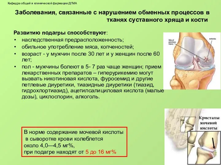 Заболевания, связанные с нарушением обменных процессов в тканях cycтавного хряща