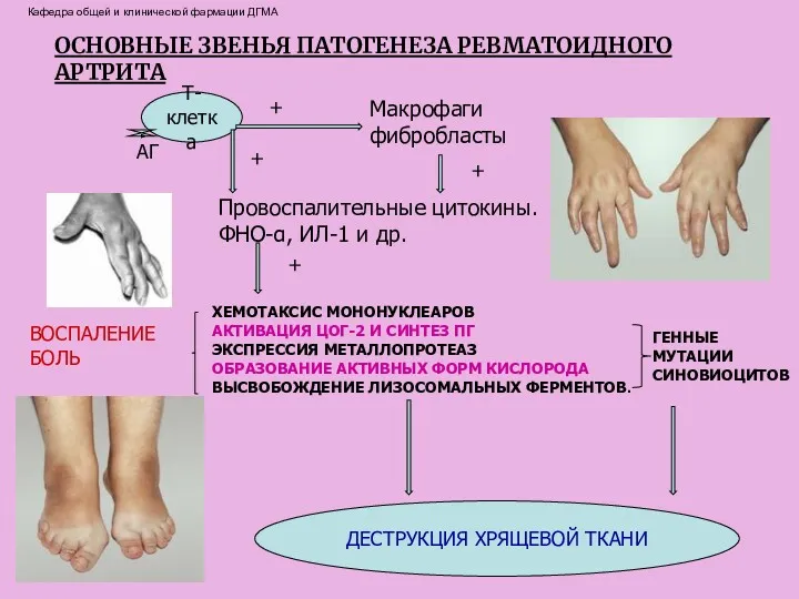 Т-клетка АГ + Макрофаги фибробласты + Провоспалительные цитокины. ФНО-α, ИЛ-1