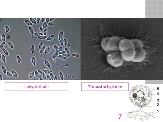 LABYRINTHULOMYCOTA Labyrinthula Thraustochytrium