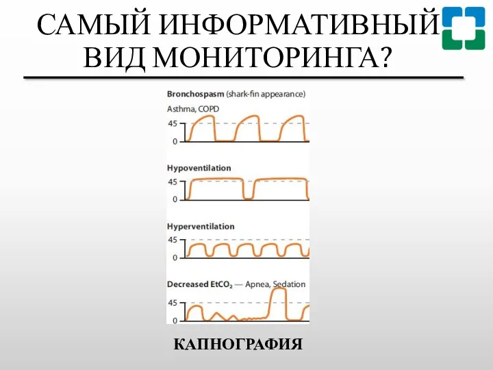 САМЫЙ ИНФОРМАТИВНЫЙ ВИД МОНИТОРИНГА? КАПНОГРАФИЯ