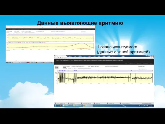 Данные выявляющие аритмию 1 сеанс испытуемого (данные с явной аритмией)