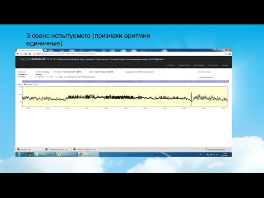 3 сеанс испытуемого (признаки аритмии единичные)