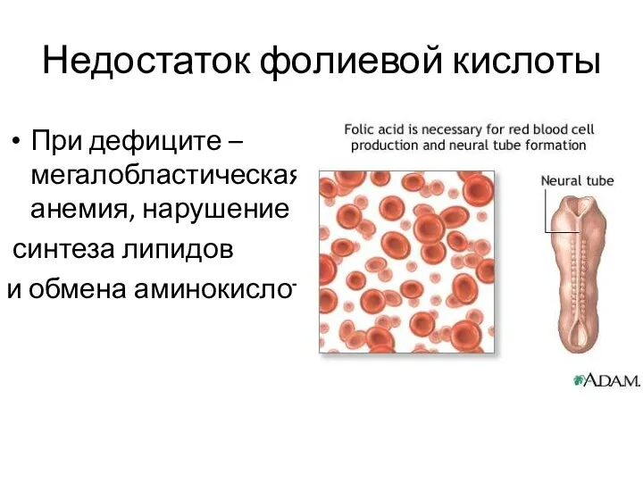 Недостаток фолиевой кислоты При дефиците – мегалобластическая анемия, нарушение синтеза липидов и обмена аминокислот