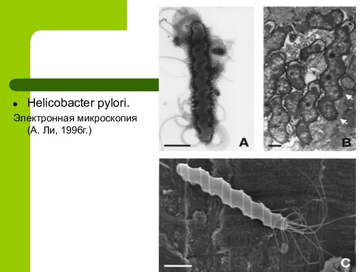 Helicobacter pylori. Электронная микроскопия (А. Ли, 1996г.)