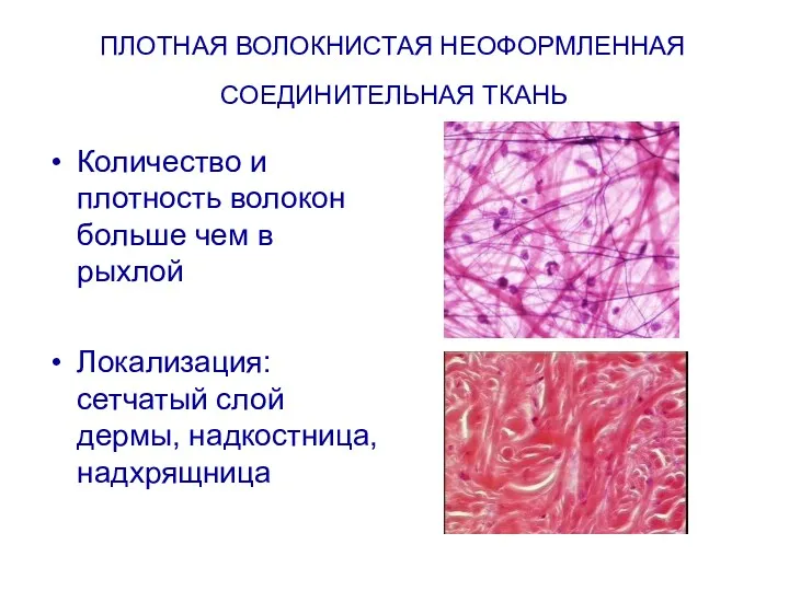 ПЛОТНАЯ ВОЛОКНИСТАЯ НЕОФОРМЛЕННАЯ СОЕДИНИТЕЛЬНАЯ ТКАНЬ Количество и плотность волокон больше