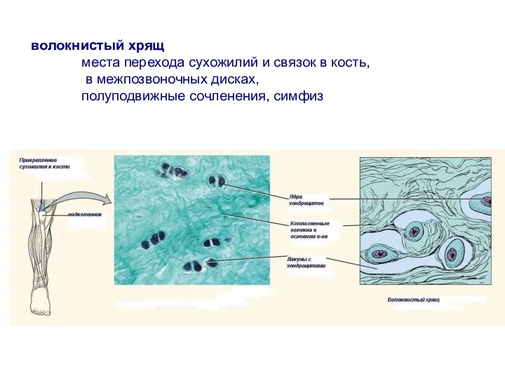 волокнистый хрящ места перехода сухожилий и связок в кость, в межпозвоночных дисках, полуподвижные сочленения, симфиз