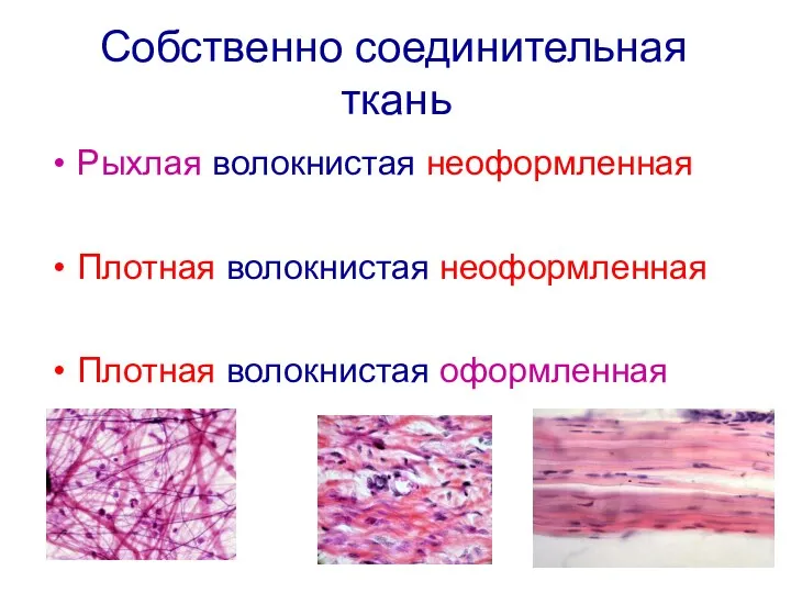 Собственно соединительная ткань Рыхлая волокнистая неоформленная Плотная волокнистая неоформленная Плотная волокнистая оформленная