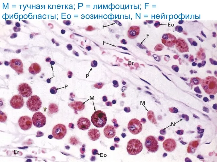 M = тучная клетка; P = лимфоциты; F = фибробласты; Eo = эозинофилы, N = нейтрофилы