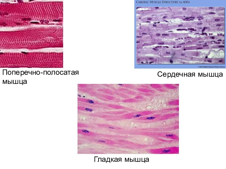 Поперечно-полосатая мышца Сердечная мышца Гладкая мышца