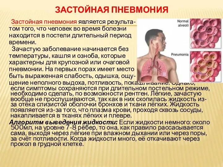 ЗАСТОЙНАЯ ПНЕВМОНИЯ Застойная пневмония является результа- том того, что человек