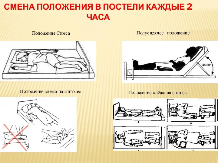 СМЕНА ПОЛОЖЕНИЯ В ПОСТЕЛИ КАЖДЫЕ 2 ЧАСА Положение Симса Положение