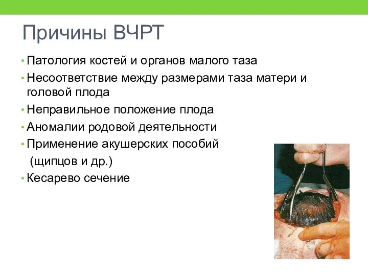 Причины ВЧРТ Патология костей и органов малого таза Несоответствие между