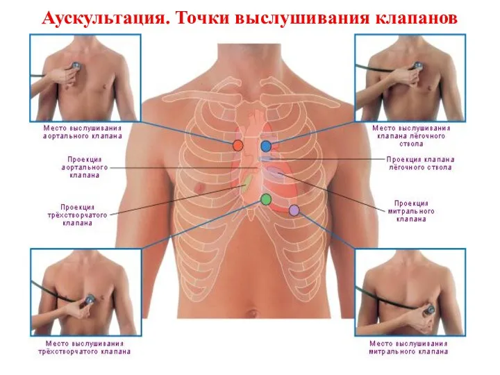 Аускультация. Точки выслушивания клапанов