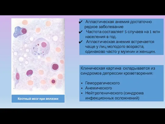 Костный мозг при аплазии Апластическая анемия достаточно редкое заболевание Частота