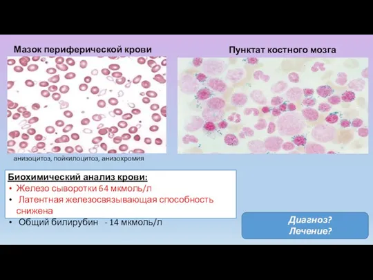 Мазок периферической крови Пунктат костного мозга Биохимический анализ крови: Железо