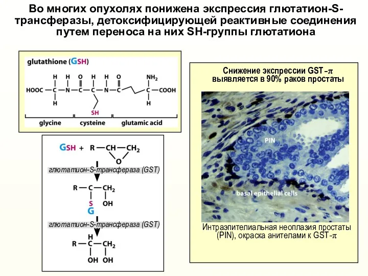 Во многих опухолях понижена экспрессия глютатион-S- трансферазы, детоксифицирующей реактивные соединения