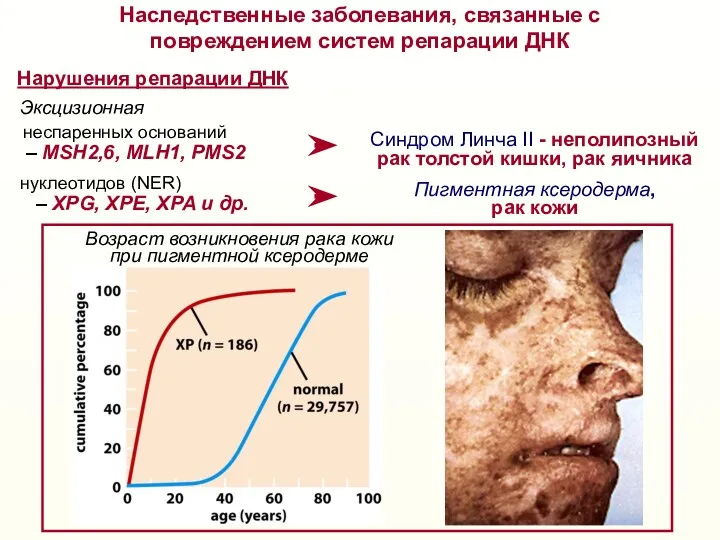 – MSH2,6, MLH1, PMS2 неспаренных оснований Нарушения репарации ДНК –