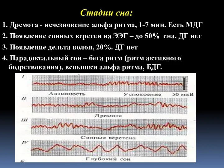 Стадии сна: 1. Дремота - исчезновение альфа ритма, 1-7 мин.