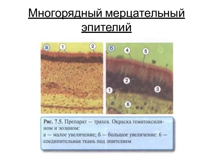 Многорядный мерцательный эпителий