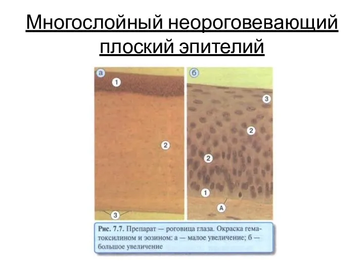 Многослойный неороговевающий плоский эпителий