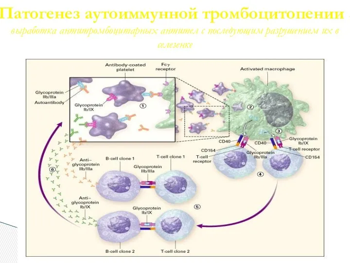 Патогенез аутоиммунной тромбоцитопении -выработка антитромбоцитарных антител с последующим разрушением их в селезенке