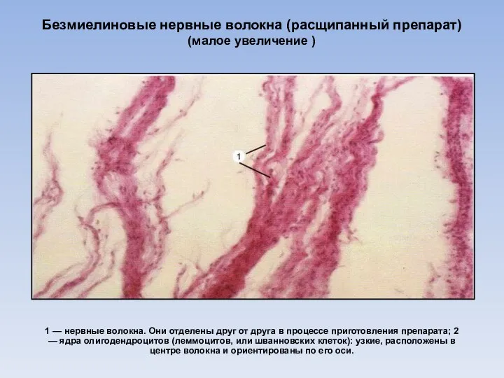 Безмиелиновые нервные волокна (расщипанный препарат) (малое увеличение ) 1 — нервные волокна. Они