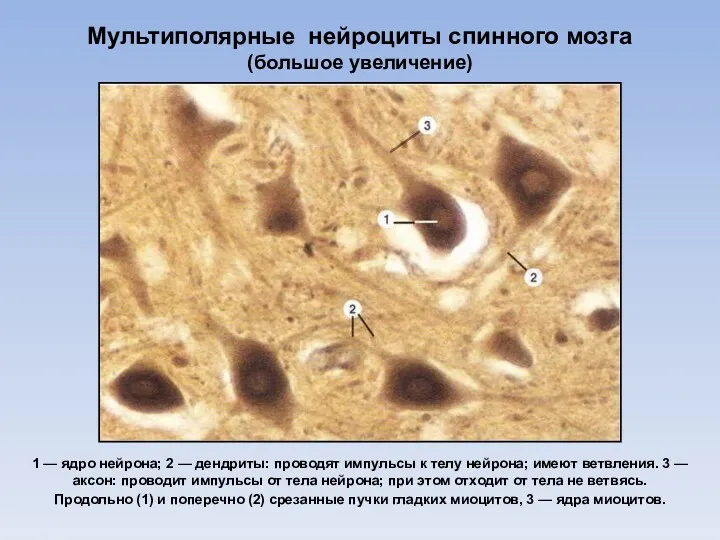 Мультиполярные нейроциты спинного мозга (большое увеличение) 1 — ядро нейрона; 2 — дендриты: