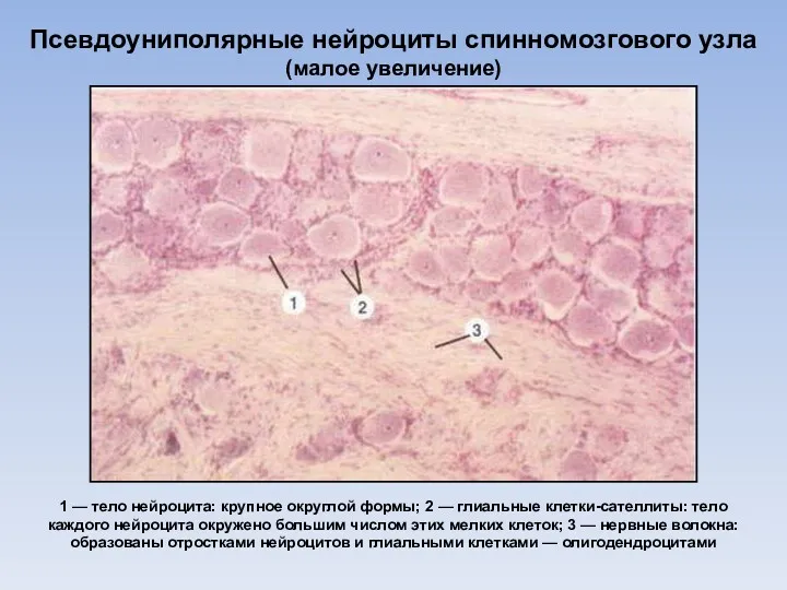 Псевдоуниполярные нейроциты спинномозгового узла (малое увеличение) 1 — тело нейроцита: крупное округлой формы;
