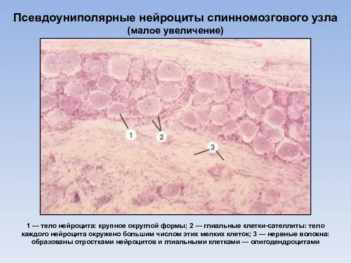 Псевдоуниполярные нейроциты спинномозгового узла (малое увеличение) 1 — тело нейроцита: