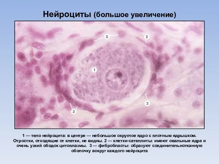 Нейроциты (большое увеличение) 1 — тело нейроцита: в центре —