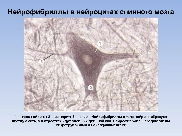 Нейрофибриллы в нейроцитах спинного мозга 1 — тело нейрона; 2 — дендрит; 3