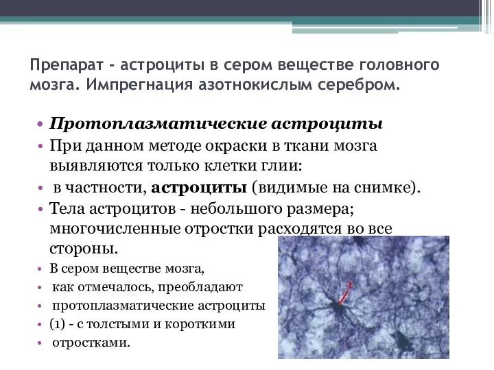 Препарат - астроциты в сером веществе головного мозга. Импрегнация азотнокислым