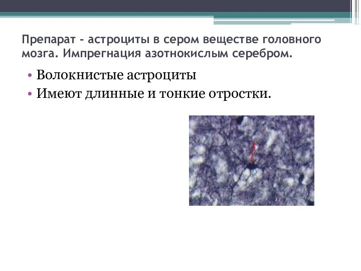 Препарат - астроциты в сером веществе головного мозга. Импрегнация азотнокислым