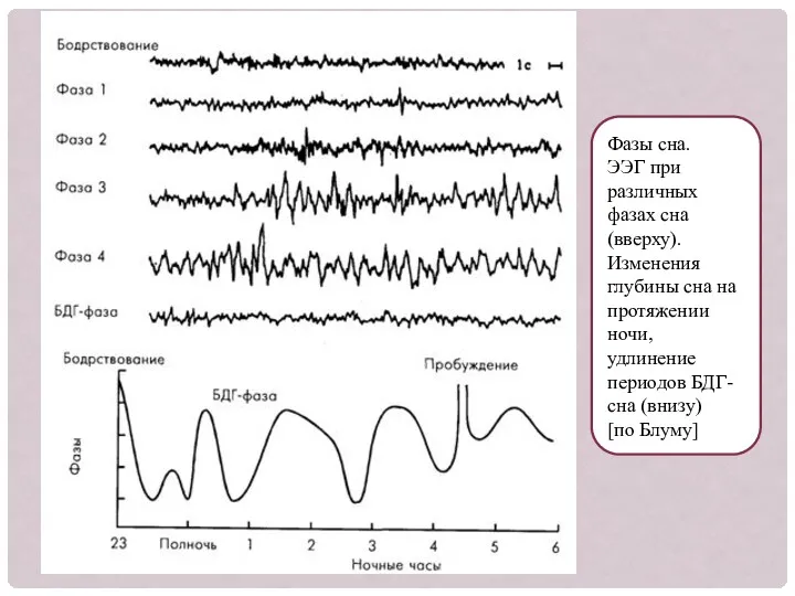 Фазы сна. ЭЭГ при различных фазах сна (вверху). Изменения глубины