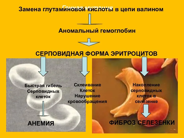 Генная мутация Замена глутаминовой кислоты в цепи валином Аномальный гемоглобин