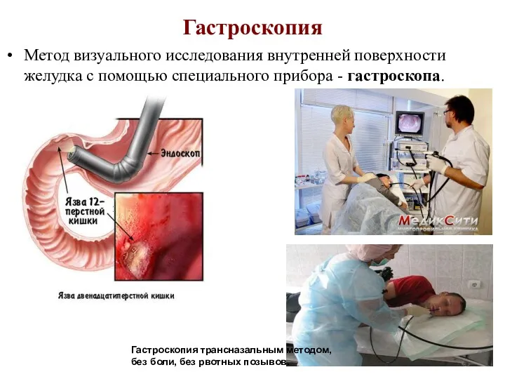 Гастроскопия Метод визуального исследования внутренней поверхности желудка с помощью специального