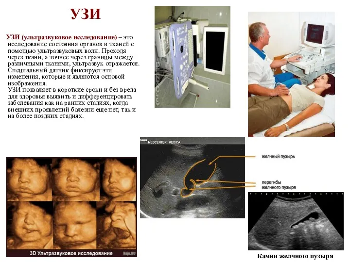 УЗИ УЗИ (ультразвуковое исследование) – это исследование состояния органов и