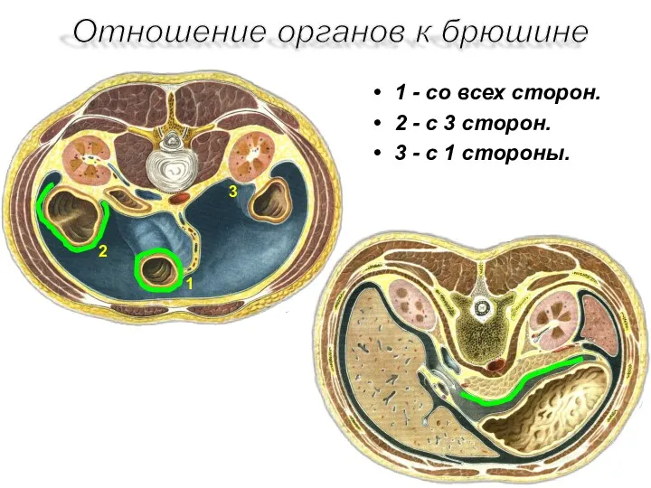 1 - со всех сторон. 2 - с 3 сторон.