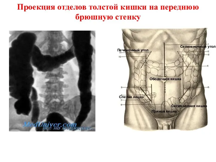 Проекция отделов толстой кишки на переднюю брюшную стенку Печеночный угол